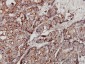 GBA Antibody (monoclonal) (M01)